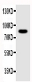 Nlrp4g Antibody - Anti-NLRP4G antibody, Western blottingWB: Mouse Ovary Tissue Lysate