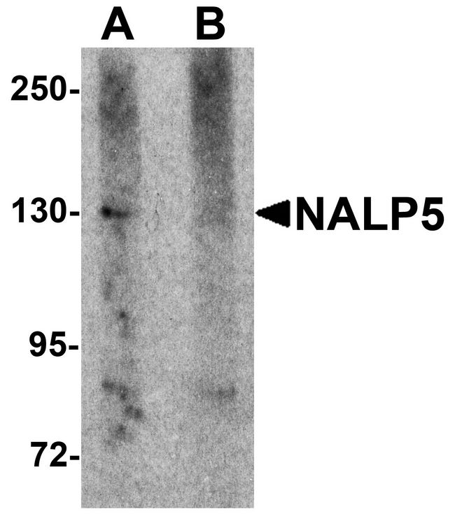 NLRP5 / NALP5 Antibody - Western blot analysis of NALP5 in mouse brain tissue lysate with NALP5 antibody at 1 ug/ml in (A) the absence and (B) the presence of blocking peptide.