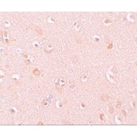NLRP5 / NALP5 Antibody - Immunohistochemistry of NALP5 in human brain tissue with NALP5 antibody at 10 µg/mL.