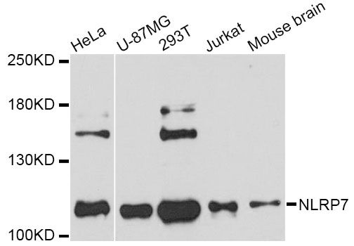 NLRP7 / NALP7 Antibody - Western blot analysis of extracts of various cell lines, using NLRP7 Antibody at 1:3000 dilution. The secondary antibody used was an HRP Goat Anti-Rabbit IgG (H+L) at 1:10000 dilution. Lysates were loaded 25ug per lane and 3% nonfat dry milk in TBST was used for blocking. An ECL Kit was used for detection and the exposure time was 40s.