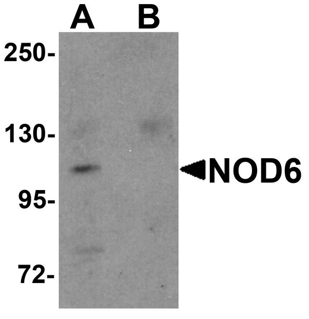 NLRP9 Antibody - Western blot analysis of NOD6 in EL4 cell lysate with NOD6 antibody at 1 ug/ml in the (A) absence and (B) presence of blocking peptide.