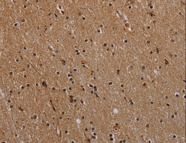 NLRP9 Antibody - Immunohistochemistry of paraffin-embedded Human brain using NLRP9 Polyclonal Antibody at dilution of 1:40.