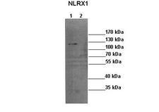 NLRX1 Antibody - Western blot of mouse neuroblastoma tumor. Lane 1: 35 ug mouse neuroblastoma cells with empty vector. Lane 2: 35 ug mouse neuroblastoma cells with NLRX1 siRNA. NLRX1 Antibody Dilution 1:1000.  This image was taken for the unconjugated form of this product. Other forms have not been tested.