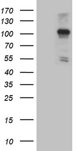 NLRX1 Antibody - HEK293T cells were transfected with the pCMV6-ENTRY control. (Left lane) or pCMV6-ENTRY NLRX1. (Right lane) cDNA for 48 hrs and lysed. Equivalent amounts of cell lysates. (5 ug per lane) were separated by SDS-PAGE and immunoblotted with anti-NLRX1. (1:2000)