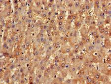 NLRX1 Antibody - Immunohistochemistry of paraffin-embedded human liver tissue using NLRX1 Antibody at dilution of 1:100