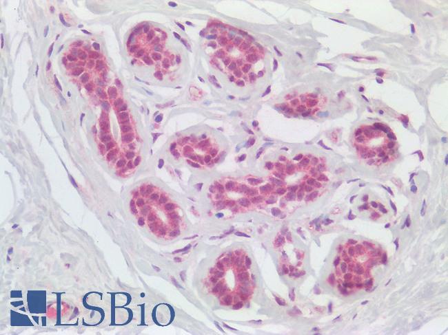 NLRX1 Antibody - Human Breast: Formalin-Fixed, Paraffin-Embedded (FFPE)