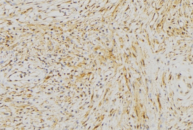 NLRX1 Antibody - 1:100 staining mouse muscle tissue by IHC-P. The sample was formaldehyde fixed and a heat mediated antigen retrieval step in citrate buffer was performed. The sample was then blocked and incubated with the antibody for 1.5 hours at 22°C. An HRP conjugated goat anti-rabbit antibody was used as the secondary.