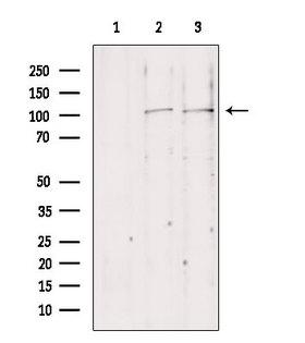 NLRX1 Antibody - Western blot analysis of extracts of various samples using NLRX1 antibody. Lane 1: mouse Myeloma cells treated with blocking peptide. Lane 2: mouse Myeloma cells; Lane 3: mouse lung;