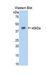 NMB / Neuromedin B Antibody - Western blot of recombinant NMB / Neuromedin B.  This image was taken for the unconjugated form of this product. Other forms have not been tested.