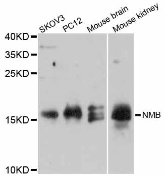 NMB / Neuromedin B Antibody - Western blot analysis of extracts of various cell lines, using NMB antibody at 1:3000 dilution. The secondary antibody used was an HRP Goat Anti-Rabbit IgG (H+L) at 1:10000 dilution. Lysates were loaded 25ug per lane and 3% nonfat dry milk in TBST was used for blocking. An ECL Kit was used for detection and the exposure time was 90s.