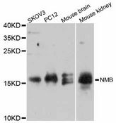 NMB / Neuromedin B Antibody - Western blot analysis of extracts of various cell lines, using NMB antibody at 1:3000 dilution. The secondary antibody used was an HRP Goat Anti-Rabbit IgG (H+L) at 1:10000 dilution. Lysates were loaded 25ug per lane and 3% nonfat dry milk in TBST was used for blocking. An ECL Kit was used for detection and the exposure time was 90s.