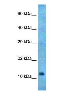 NMB / Neuromedin B Antibody - Western blot of NMB Antibody with human Stomach Tumor lysate.  This image was taken for the unconjugated form of this product. Other forms have not been tested.