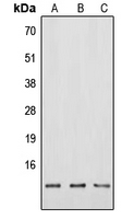 NMB / Neuromedin B Antibody - Western blot analysis of Neuromedin B expression in HEK293T (A); Raw264.7 (B); PC12 (C) whole cell lysates.