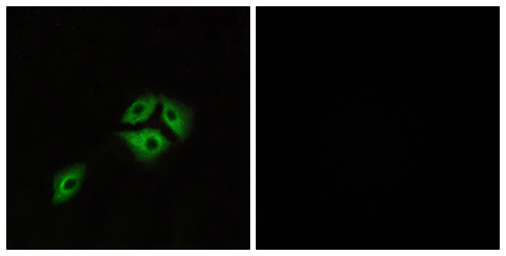 NMBR Antibody - Immunofluorescence analysis of A549 cells, using NMBR Antibody. The picture on the right is blocked with the synthesized peptide.