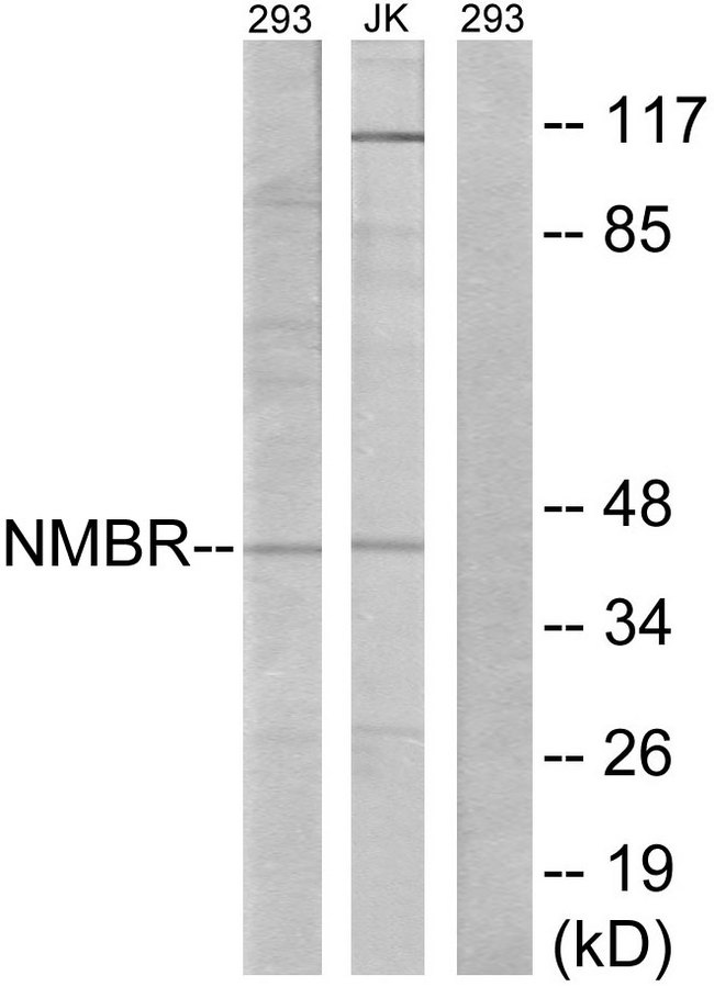 NMBR Antibody - Western blot analysis of lysates from 293 and Jurkat cells, using NMBR Antibody. The lane on the right is blocked with the synthesized peptide.
