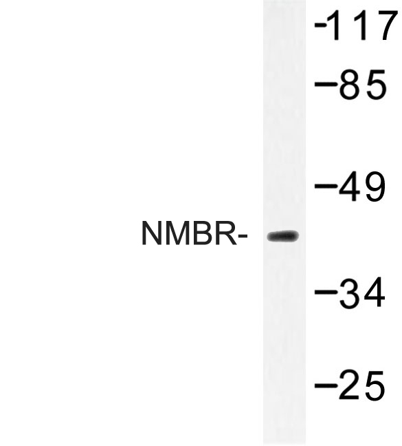 NMBR Antibody - Western blot of NMBR (L264) pAb in extracts from 293 cells.