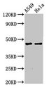NMBR Antibody - Positive Western Blot detected in A549 whole cell lysate, Hela whole cell lysate. All lanes: NMBR antibody at 4.4 µg/ml Secondary Goat polyclonal to rabbit IgG at 1/50000 dilution. Predicted band size: 44 KDa. Observed band size: 44 KDa