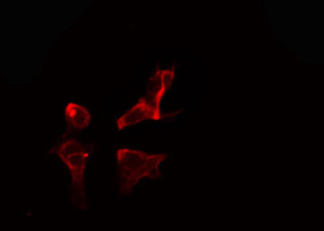 NMBR Antibody - Staining 293 cells by IF/ICC. The samples were fixed with PFA and permeabilized in 0.1% Triton X-100, then blocked in 10% serum for 45 min at 25°C. The primary antibody was diluted at 1:200 and incubated with the sample for 1 hour at 37°C. An Alexa Fluor 594 conjugated goat anti-rabbit IgG (H+L) antibody, diluted at 1/600, was used as secondary antibody.