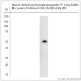 NMBR Antibody - WB on mouse tissue lysate. Blocking: 1% LFDM for 30 min at RT; primary antibody: dilution 1:500 incubated overnight at 4°C.