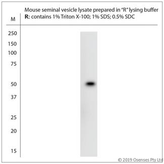 NMBR Antibody - WB on mouse tissue lysate. Blocking: 1% LFDM for 30 min at RT; primary antibody: dilution 1:500 incubated overnight at 4°C.