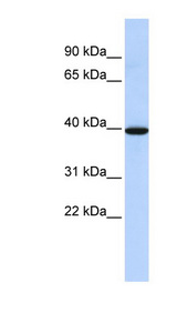 NMBR Antibody - NMBR antibody Western blot of Fetal Brain lysate. This image was taken for the unconjugated form of this product. Other forms have not been tested.