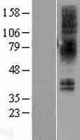 NMBR Protein - Western validation with an anti-DDK antibody * L: Control HEK293 lysate R: Over-expression lysate