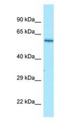 NMD3 Antibody - NMD3 antibody Western Blot of Fetal kidney.  This image was taken for the unconjugated form of this product. Other forms have not been tested.