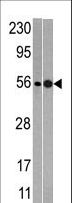 NMD3 Antibody - Western blot of anti-NMD3 antibody in mouse heart (left) and T47D (right)tissue lysates (35 ug/lane). NMD3(arrow) was detected using the purified antibody.