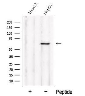 NMD3 Antibody - Western blot analysis of extracts of HepG2 cells using NMD3 antibody. The lane on the left was treated with blocking peptide.