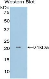 NME1 / NM23 Antibody - Western blot of recombinant NME1 / NM23.  This image was taken for the unconjugated form of this product. Other forms have not been tested.