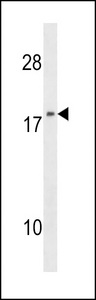 NME1 / NM23 Antibody - NME1 Antibody (F40) western blot of 293 cell line lysates (35 ug/lane). The NME1 antibody detected the NME1 protein (arrow).