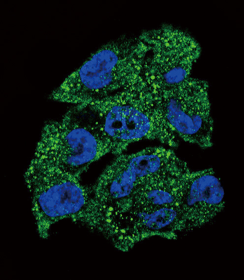 NME1 / NM23 Antibody - Confocal immunofluorescence of NM23 (NME1) Antibody with A375 cell followed by Alexa Fluor 488-conjugated goat anti-rabbit lgG (green). DAPI was used to stain the cell nuclear (blue).