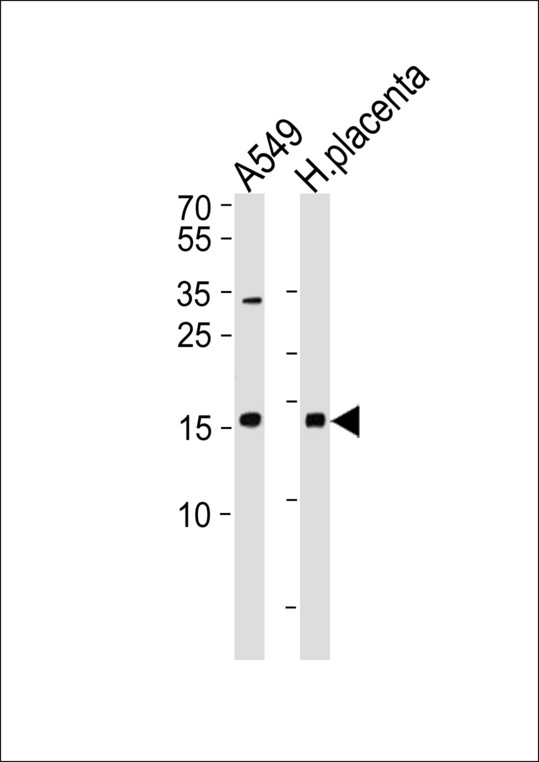 NME1 / NM23 Antibody - NME1 Antibody western blot of A549 cell line and human placenta lysates (35 ug/lane). The NME1 antibody detected the NME1 protein (arrow).