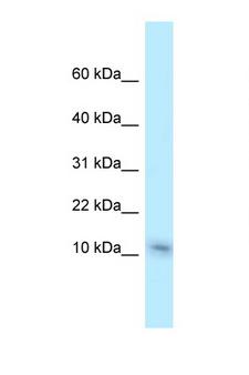 NME1 / NM23 Antibody - NME1 antibody Western blot of Mouse Liver lysate. Antibody concentration 1 ug/ml.  This image was taken for the unconjugated form of this product. Other forms have not been tested.