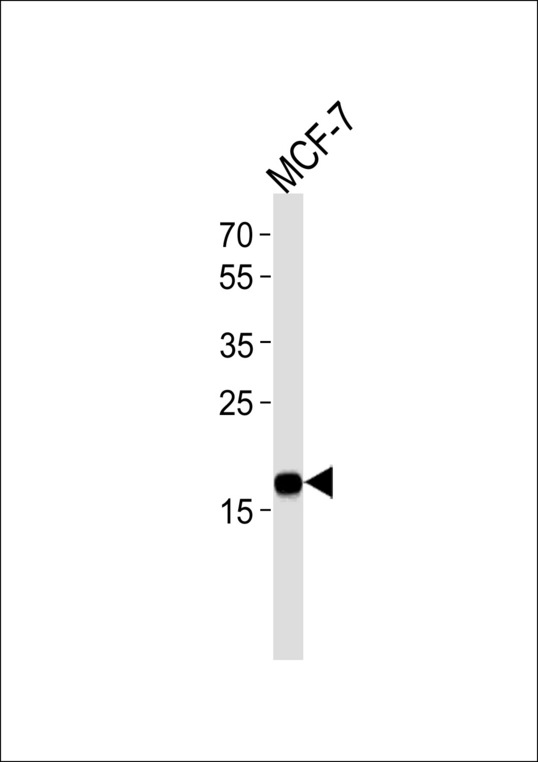 NME1 / NM23 Antibody - NME1 Antibody western blot of MCF-7 cell line lysates (35 ug/lane). The NME1 antibody detected the NME1 protein (arrow).