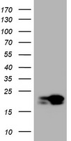 NME1 / NM23 Antibody - HEK293T cells were transfected with the pCMV6-ENTRY control (Left lane) or pCMV6-ENTRY NME1 (Right lane) cDNA for 48 hrs and lysed. Equivalent amounts of cell lysates (5 ug per lane) were separated by SDS-PAGE and immunoblotted with anti-NME1.