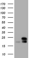 NME1 / NM23 Antibody - HEK293T cells were transfected with the pCMV6-ENTRY control (Left lane) or pCMV6-ENTRY NME1 (Right lane) cDNA for 48 hrs and lysed. Equivalent amounts of cell lysates (5 ug per lane) were separated by SDS-PAGE and immunoblotted with anti-NME1.