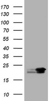 NME1 / NM23 Antibody - HEK293T cells were transfected with the pCMV6-ENTRY control (Left lane) or pCMV6-ENTRY NME1 (Right lane) cDNA for 48 hrs and lysed. Equivalent amounts of cell lysates (5 ug per lane) were separated by SDS-PAGE and immunoblotted with anti-NME1.