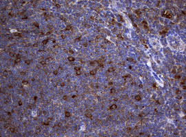 NME1 / NM23 Antibody - IHC of paraffin-embedded Human tonsil using anti-NME1 mouse monoclonal antibody.