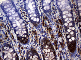 NME1 / NM23 Antibody - IHC of paraffin-embedded Human colon tissue using anti-NME1 mouse monoclonal antibody.