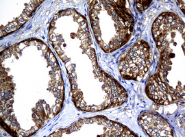 NME1 / NM23 Antibody - IHC of paraffin-embedded Human prostate tissue using anti-NME1 mouse monoclonal antibody.