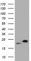 NME1 / NM23 Antibody - HEK293T cells were transfected with the pCMV6-ENTRY control (Left lane) or pCMV6-ENTRY NME1 (Right lane) cDNA for 48 hrs and lysed. Equivalent amounts of cell lysates (5 ug per lane) were separated by SDS-PAGE and immunoblotted with anti-NME1.