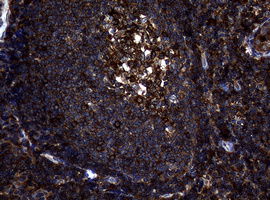 NME1 / NM23 Antibody - IHC of paraffin-embedded Human tonsil using anti-NME1 mouse monoclonal antibody.