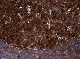 NME1 / NM23 Antibody - IHC of paraffin-embedded Human tonsil using anti-NME1 mouse monoclonal antibody.