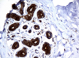 NME1 / NM23 Antibody - IHC of paraffin-embedded Human breast tissue using anti-NME1 mouse monoclonal antibody.