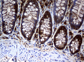 NME1 / NM23 Antibody - IHC of paraffin-embedded Human colon tissue using anti-NME1 mouse monoclonal antibody.