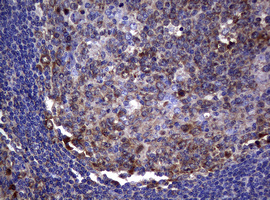 NME1 / NM23 Antibody - IHC of paraffin-embedded Human tonsil using anti-NME1 mouse monoclonal antibody.