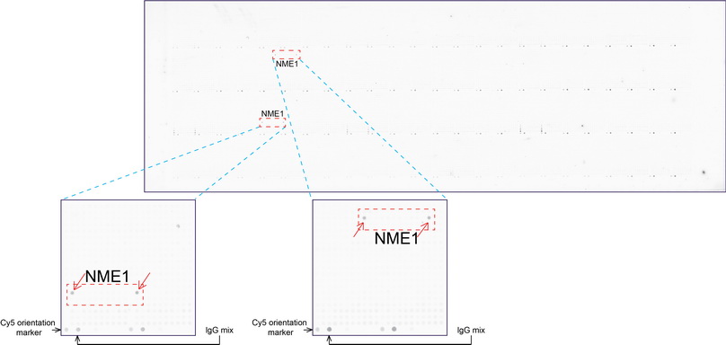 NME1 / NM23 Antibody - OriGene overexpression protein microarray chip was immunostained with UltraMAB anti-NME1 mouse monoclonal antibody. The positive reactive proteins are highlighted with two red arrows in the enlarged subarray. All the positive controls spotted in this subarray are also labeled for clarification.