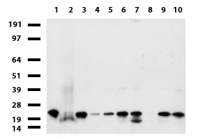 NME1 / NM23 Antibody - Western blot of human tissue lysates. (15ug) from 10 different tissues. (1: Testis, 2: Omentum, 3: Uterus, 4: Breast, 5: Brain, 6: Liver, 7: Ovary, 8: Thyroid, 9: Colon, 10: Spleen). Diluation: 1:500.