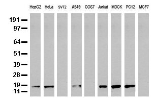 NME1 / NM23 Antibody - Western blot analysis of extracts. (35ug) from 9 different cell lines by using anti-NME1 monoclonal antibody. (Clone UMAB92).